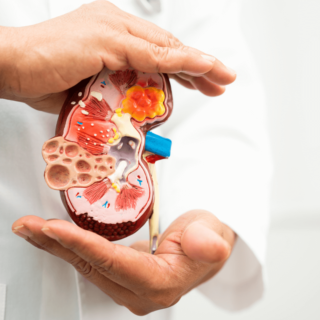 nerki, przewlekła choroba nerek, dietetyk kliniczny, dieta w chorobie nerek